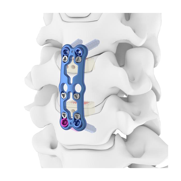 ACP Anterior Cervical Spine Locking Plate