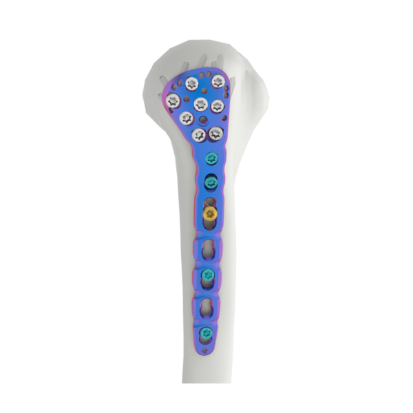 VAL Proximal Humeral Locking Plate
