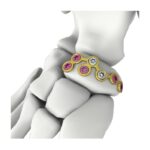 Itval Navicular Locking Plate — Блокируемая пластина для ладьевидной кости Itval